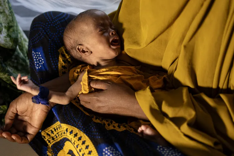 Une Somalienne nouvellement déplacée tient son bébé gravement malnutri dans ses bras dans un centre de stabilisation pour enfants souffrant de malnutrition aiguë sévère à Kismayo,